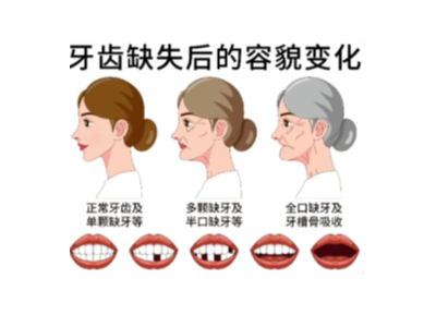 【科學(xué)科普】十個(gè)常用的口腔小知識(shí)！