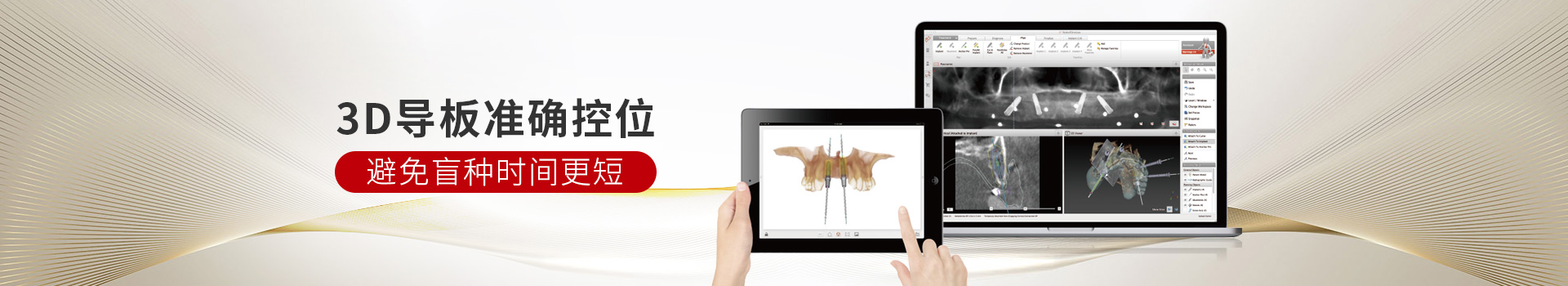惟德口腔種植牙,3D導(dǎo)板準確控位,避免盲種時間更短