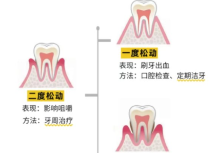老年人牙齒松動(dòng)了要怎么辦？