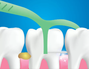 口腔問題可能要“命”！5大預(yù)警信號(hào)，別忽視