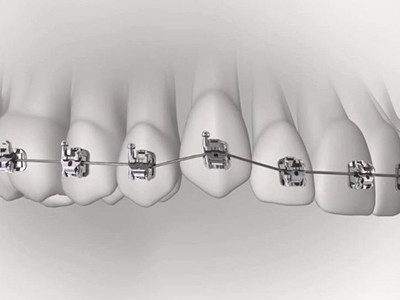 承德市哪家口腔醫(yī)院口腔正畸做得好？惟德口腔醫(yī)院來告訴您