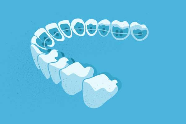 惟德口腔醫(yī)院口腔正畸好不好？